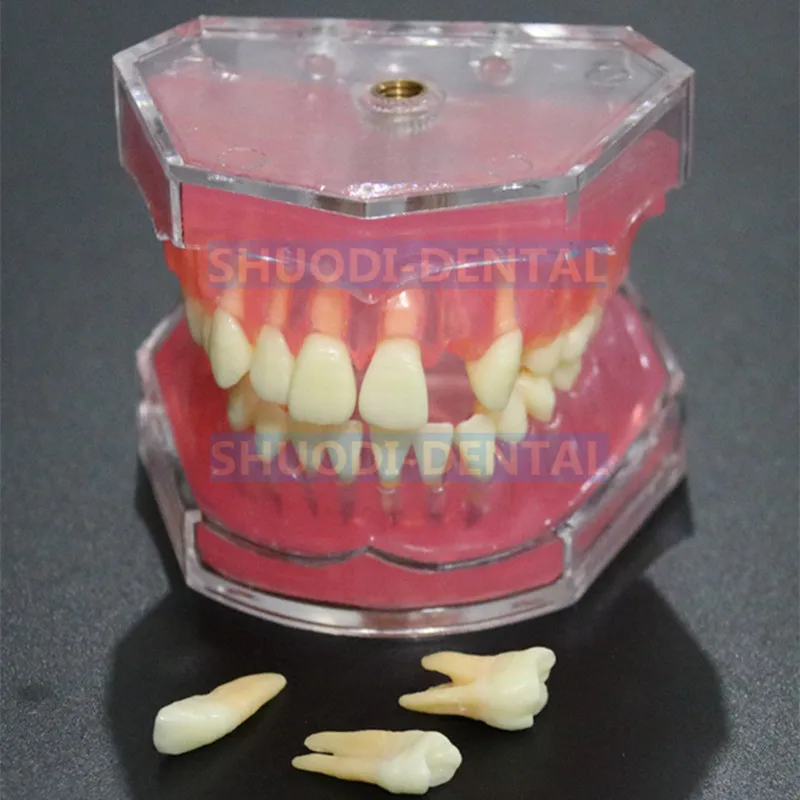 

1:1Dental Study Teaching Model Dental Standard Model Removable Teeth Soft Gum ADULT TYPODONT Model Dentist Teaching M