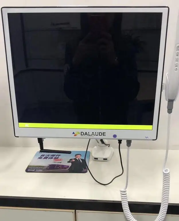 High Defination 17inch Monitor Dental Endoscrope Integrated Intraoral Camera 8mega pixel