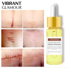 Мощный крем для ухода за кожей от растяжек, эфирное масло для беременных, Крем Для Удаления растяжек, Послеродовое восстановление ожирения