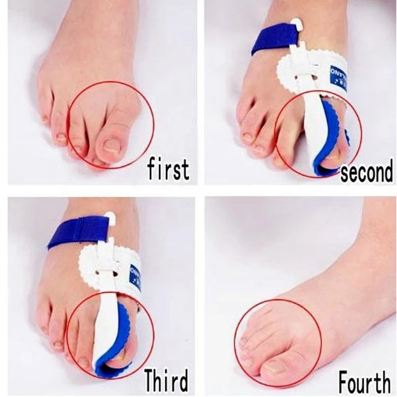 1Pair Hallux Valgus Posture Corrector Orthopedic Toe Separator Bunion Corrector Toe Straightener Foot Care Pedicure Tools