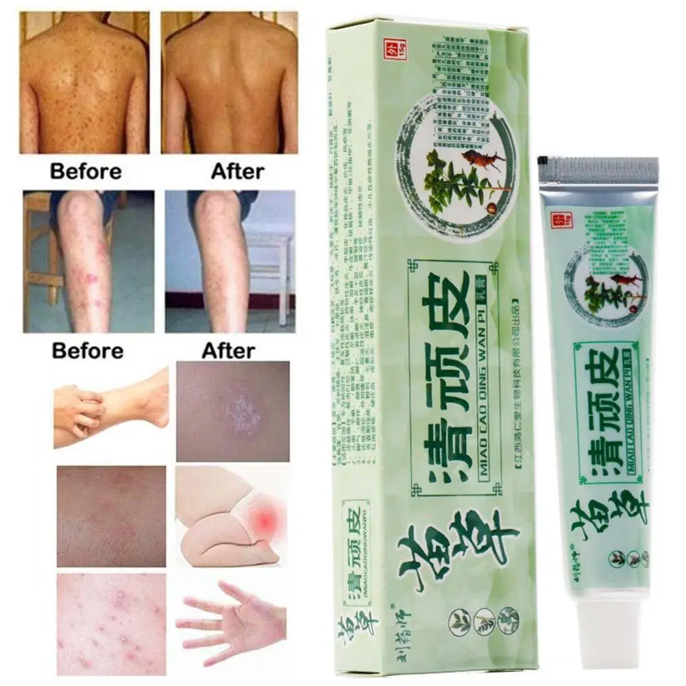 Горячая лечение псориаза крем уход за кожей дерматит экзематоидная мазь Eczema крем от псориаза зуд рельеф кожи Crea