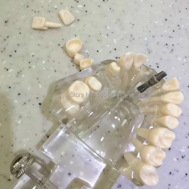  Dental materials denture model Oral removable dental pathological model Tooth Study Teach Model - 32795839251