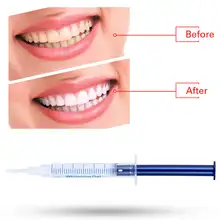 10 шт. Стоматологическая система для отбеливания полости рта набор для отбеливания зубов Стоматологическое оборудование для отбеливания зубов
