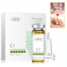 20 мл грибковое масло для ногтей бактерии Уход за ногтями лечение онихомикоза Paronychia против грибковой инфекции ногтей ремонт ногтей