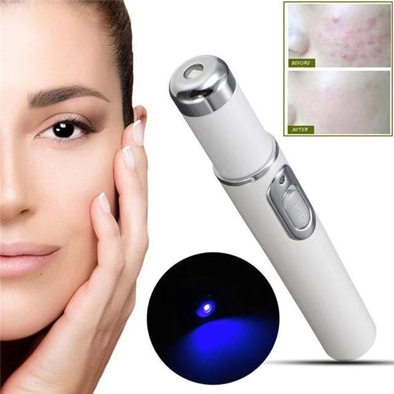 1pcs Medical Blue Light Therapy Laser Treatment Pen Soft Scar Wrinkle