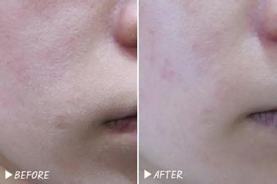 u=2918607680,3918132230&fm=21&gp=0