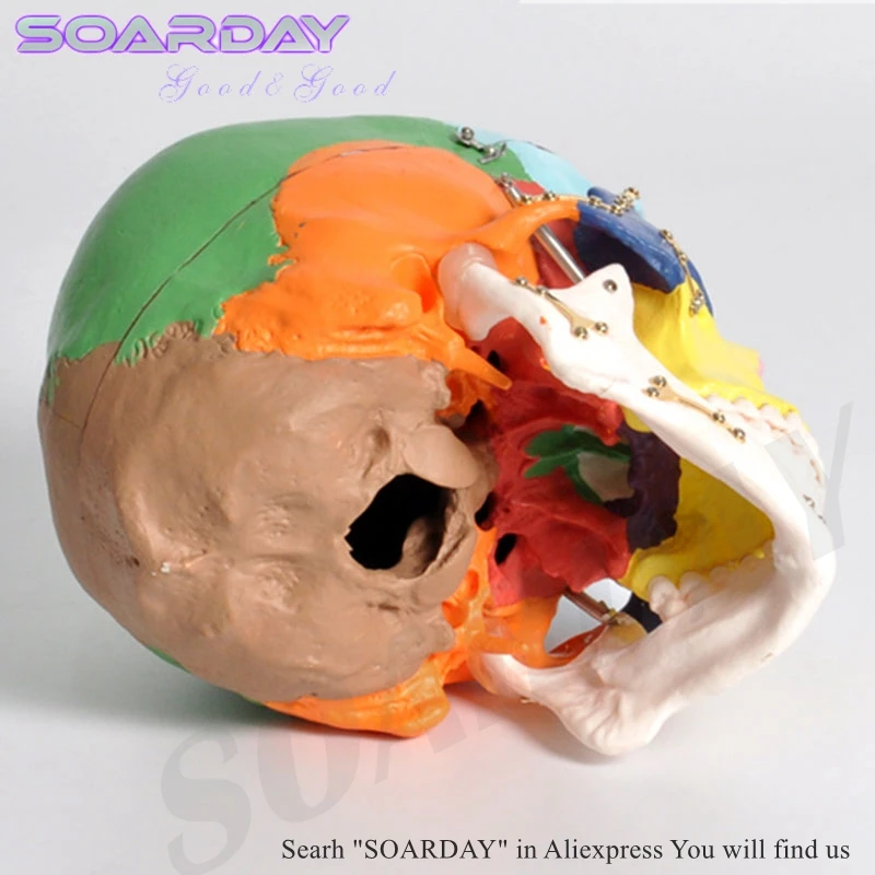 SOARDAY модель черепа с клолоурными переломами фиксированная Больничная клиника