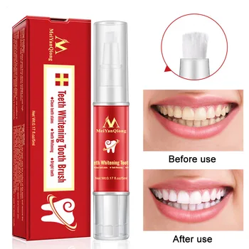 

Teeth Whitening Pen Tooth Gel Whitener Soft Brush Dental Care Teeth Whiter Teeth Care Whitening Pen Oral Hygiene