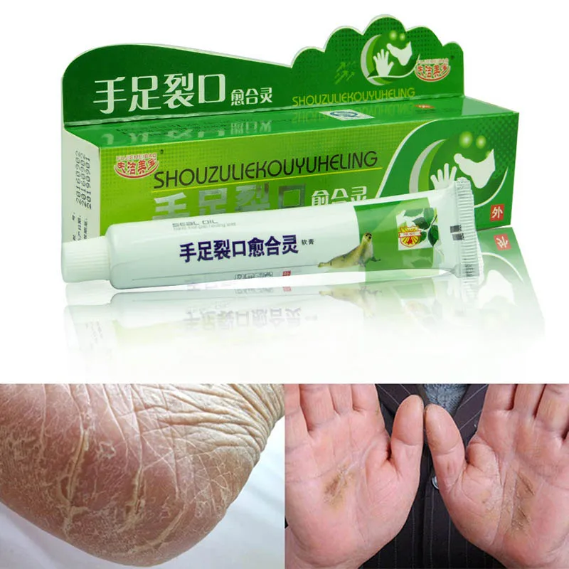  Powerful Hand Foot Crack Cream Heel Chapped Peeling Foot and hand Repair Anti Dry Crack skin care C