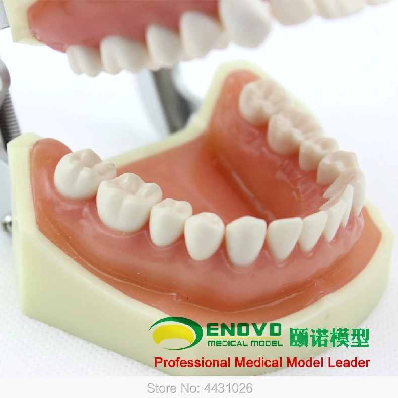 ENOVO зубных протезов зубной протез был использован подготовить десны протез
