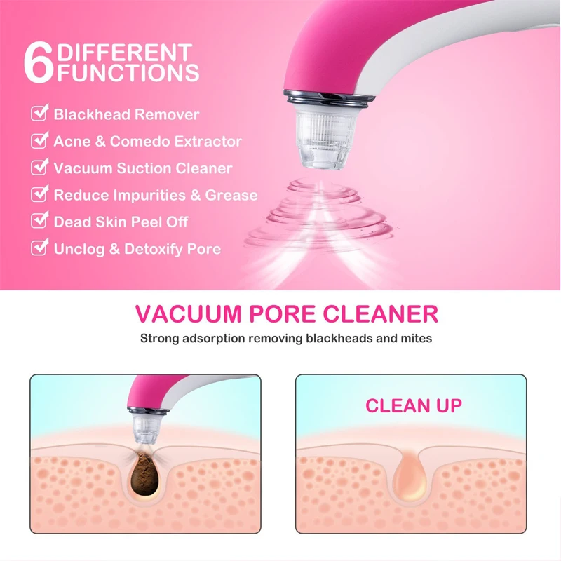 Removedor de Cravo Cuidados com a Pele Ferramenta de Vácuo de Sucção a Vácuo de Remoção de Acne Miqmi Rosto Limpa Poros Pimple Facial Dermoabrasão Diamante 11 de Sucção A Vácuo de Remoção de