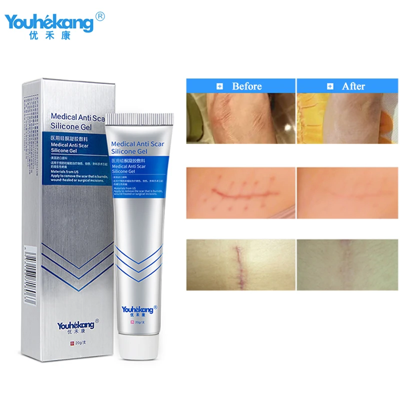 

Youhekang Medical Acne Scar Removal Cream Skin Repair Face Cream Acne Spots Acne Treatment Blackhead Whitening Cream Skin Care