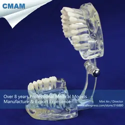 12571 cmam-dental11 реального Размеры 1:1 Прозрачный взрослых зубной модели, Медицинские товары учебных анатомические модели