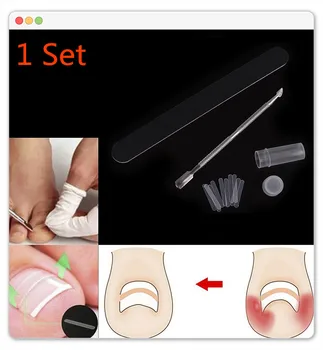 

NEW 1 Set Toenail Straightening Clip Foot Care Curved Brace Toe Nail Ingrown Toenail Patch Pusher Recover Straightening Clip