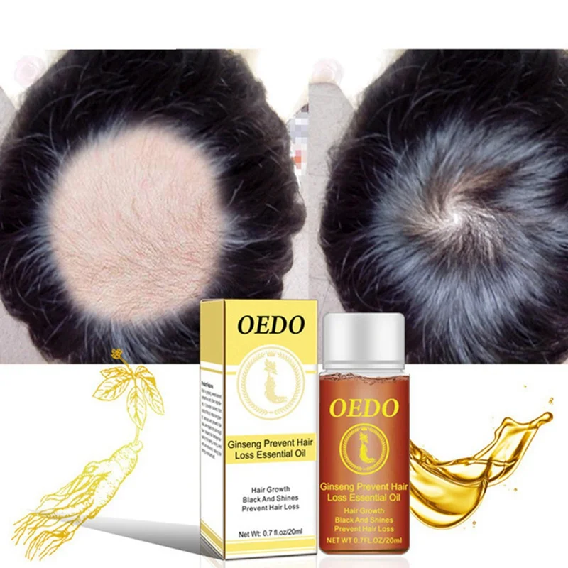 20 мл женьшеня средство для роста волос предупреждающий потерю волос Жидкое повреждение плотное быстрое восстановление роста волос