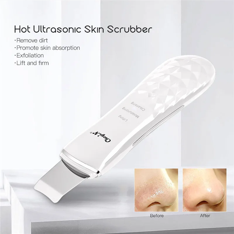 

Rechargeable Ultrasonic Skin Scrubber Face Spatula Blackhead Removal Pore Cleanser Skin Peeling Lifting Comedone Extractor
