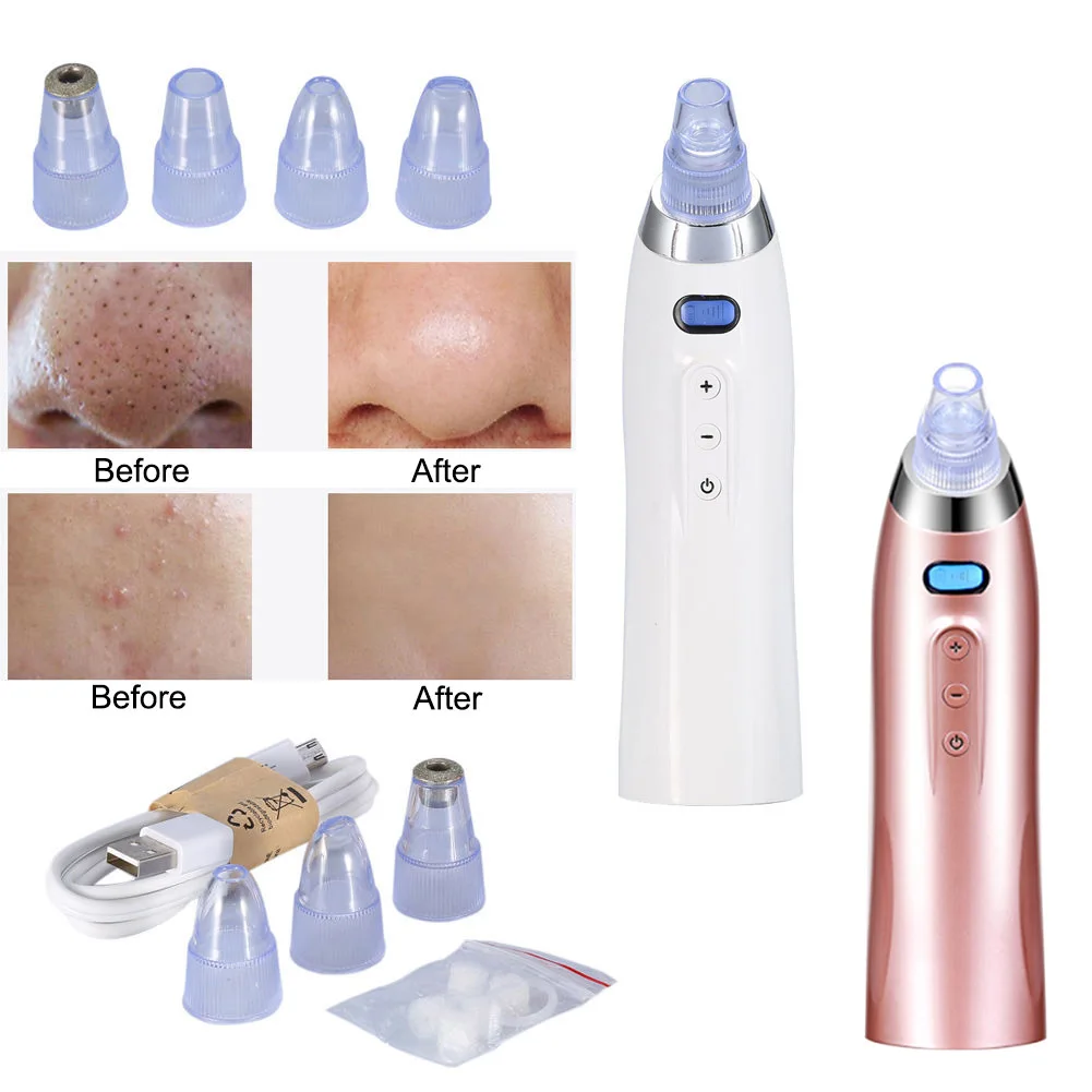 

Hot Sale Face Pore Cleaner Blackhead Remover Vacuum Comedo Suction Diamond Dermabrasion Facial Cleaning Beauty Machine JLRS 2019