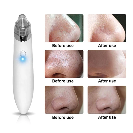 Blackhead Vacuum Extraction Removal Electronic Device