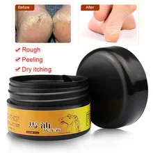 Конский масляный крем для ног Уход за ногами зуд волдыри анти-чаппинг пилинг Beriberi мазь для ног FM88