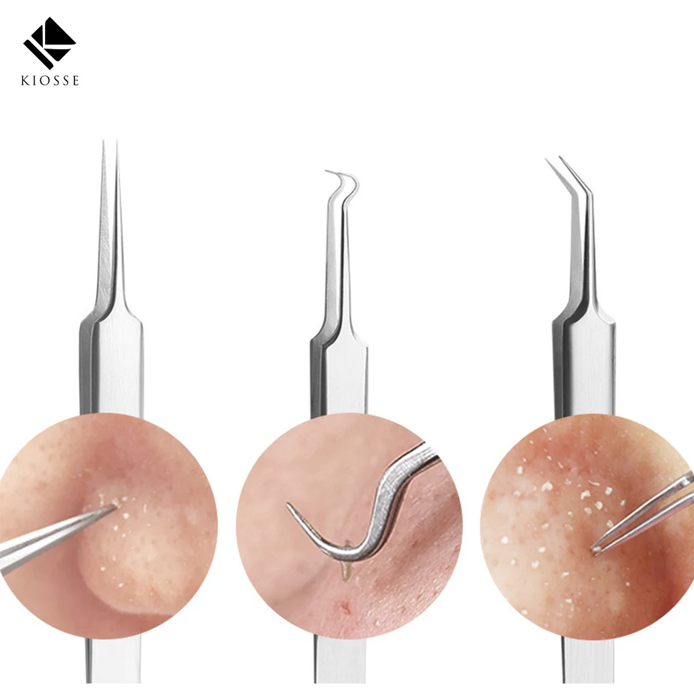 

Newest Acne Needle Tweezers Black Head Pimples Removal Pointed Bend Gib Head Face Care Tools Blackhead Acne Extractor A050 B052