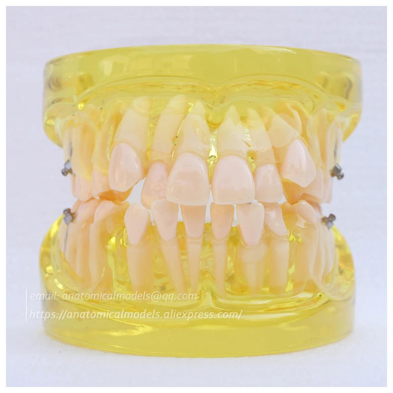 13022 DH202 Orthodontic Model 