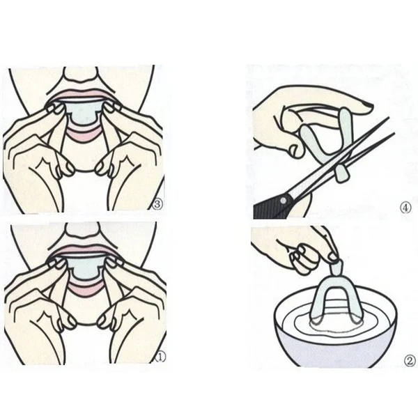 Стоматологическая ортодонтика зубные скобы отбеливание зубов ортодонтика инструмент для выравнивания зубов Ортодонтические фиксаторы