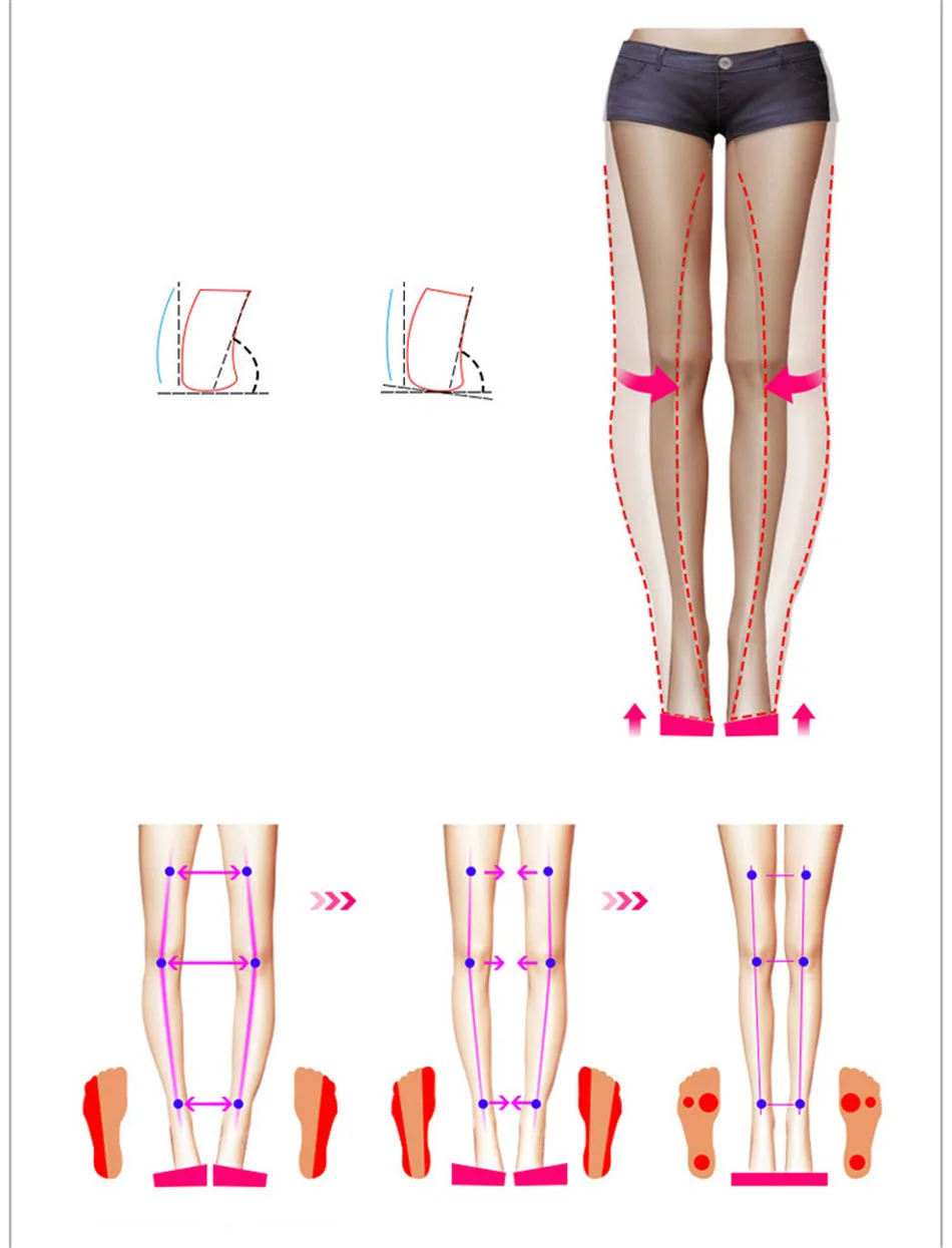 silicone shoe pads (1)