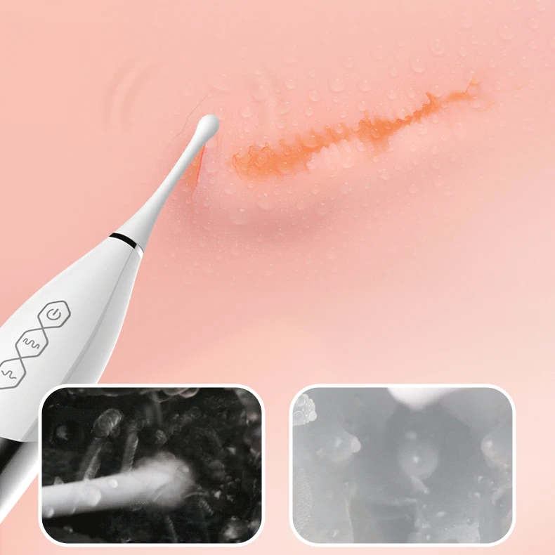 vibrator (9)