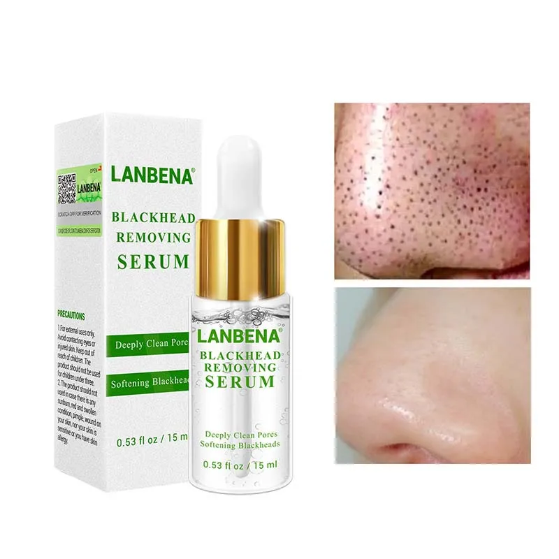 

Blackhead Removal Essence Acne Pimple Treatment Shrink Pores Purifying Skin Care HB88