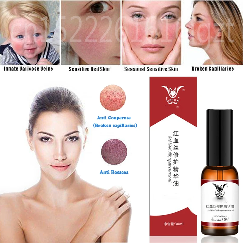red skin treatment face