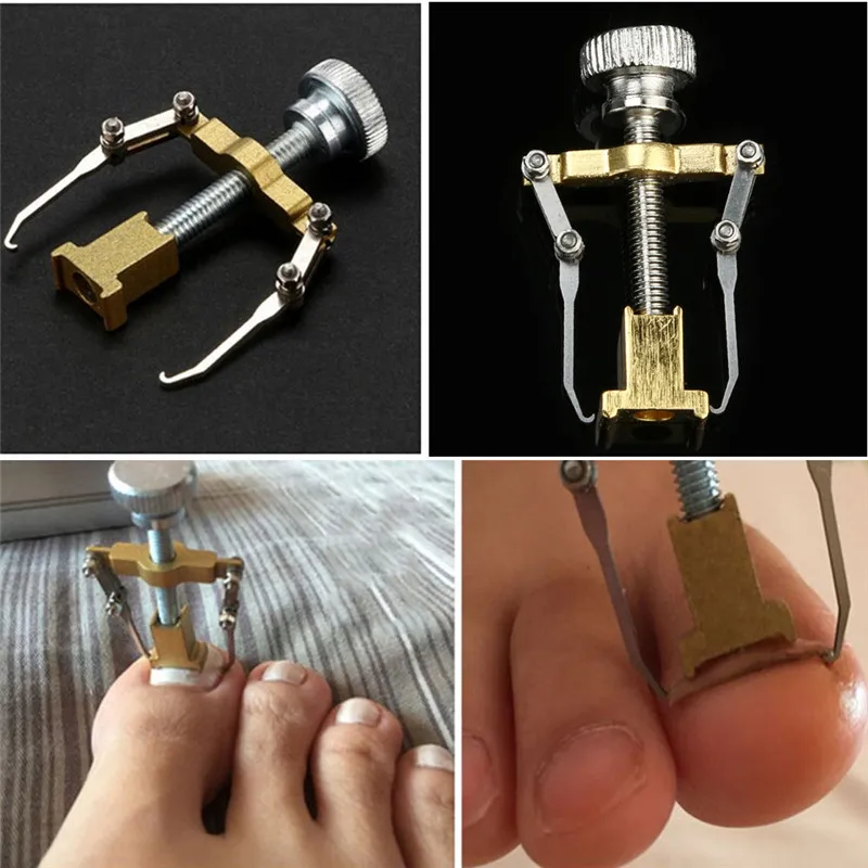 Treatment strengthener toenail brittle antifungal fixes toe kerasal sensationail improves 13ml New Arrivals Toe Nail Corrected Foot Correction Foot Pedicure Nail Care