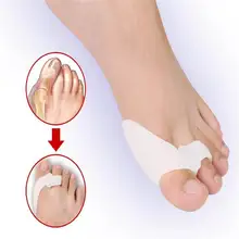 2 pçs/lote gel de silicone genuíno hallux valgusbicyclic polegar ortopédico chaves dobradas dedos do pé corrector ferramenta cuidados com os pés alívio da dor ckan