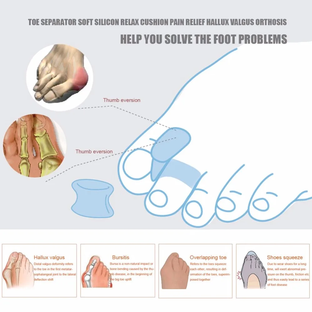 1 пара, разделитель пальцев ног, мягкий силиконовый подтяжки для ухода за ногами, профессиональные поддерживающие инструменты, расслабляющая Подушка, облегчающая боль, вальгусная деформация, Ортез