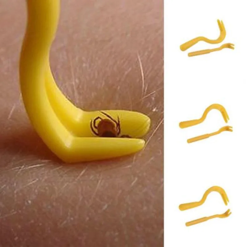 

HOT Sale 2pcs Tick Twister Remover Hook Tool Dog Horse Cat Pet