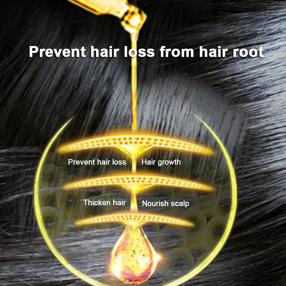 30 мл масло для роста волос увлажняющее питающее кожу головы гладкое сухое восстанавливающее лечение эссенция для ухода за волосами