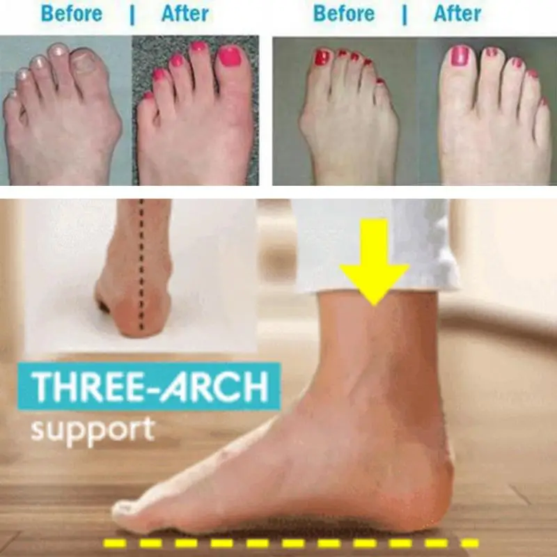

Women PU Leather Shoes Comfy Platform Flat Sole Ladies Casual Soft Big Toe Foot Correction Sandal Orthopedic Bunion Corrector