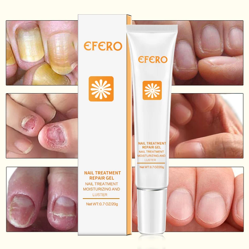 

EFERO Nail Repair Essence Serum Fungal Nail Treatment Remove Onychomycosis Hands and Feet Care of Toe Nail Nourishing Whitening