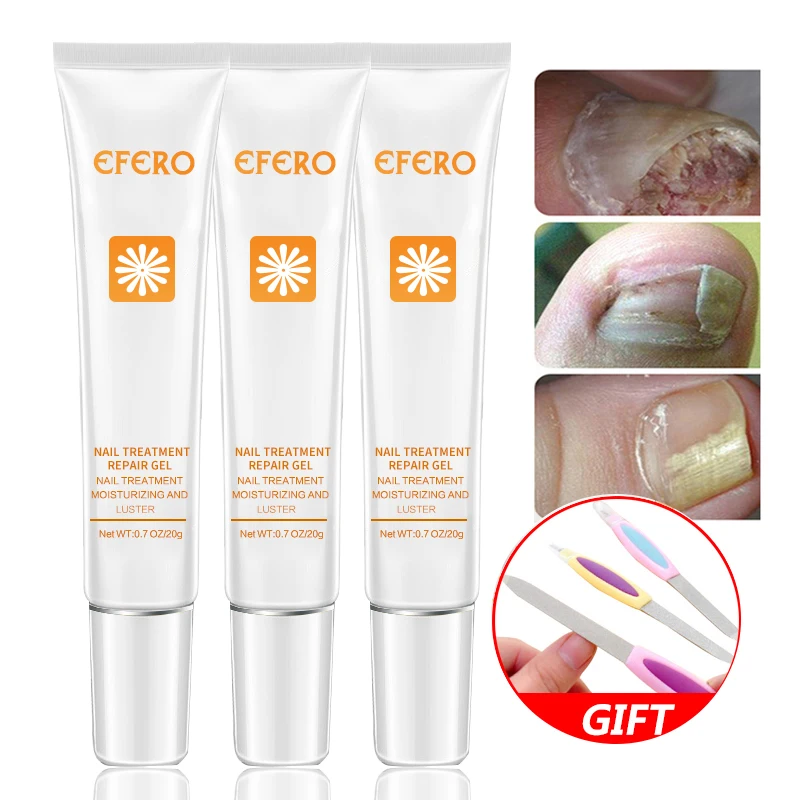 

1Pcs EFERO Nail Serum Repair Essence Fungal Nail Treatment Repair Fungus Nail Toe Nourishing Brightening Nail Gel Essence
