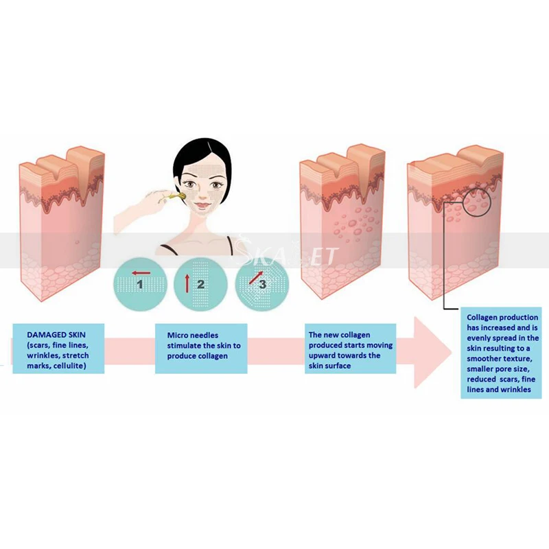Для домашнего использования 0,2/0,25/0,3 мм титановый микроиглы Дерма ролик для лица микро дермабразия дермароллер для лица