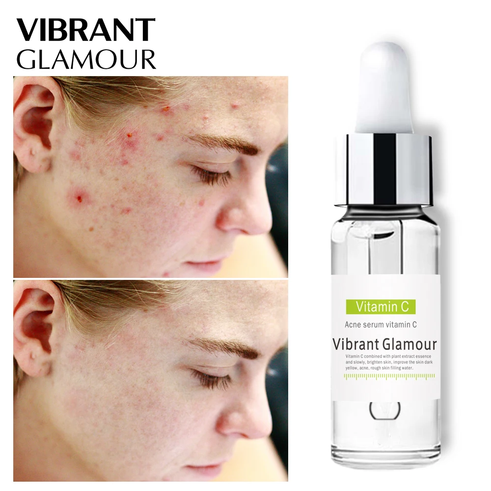 c vitamin acne