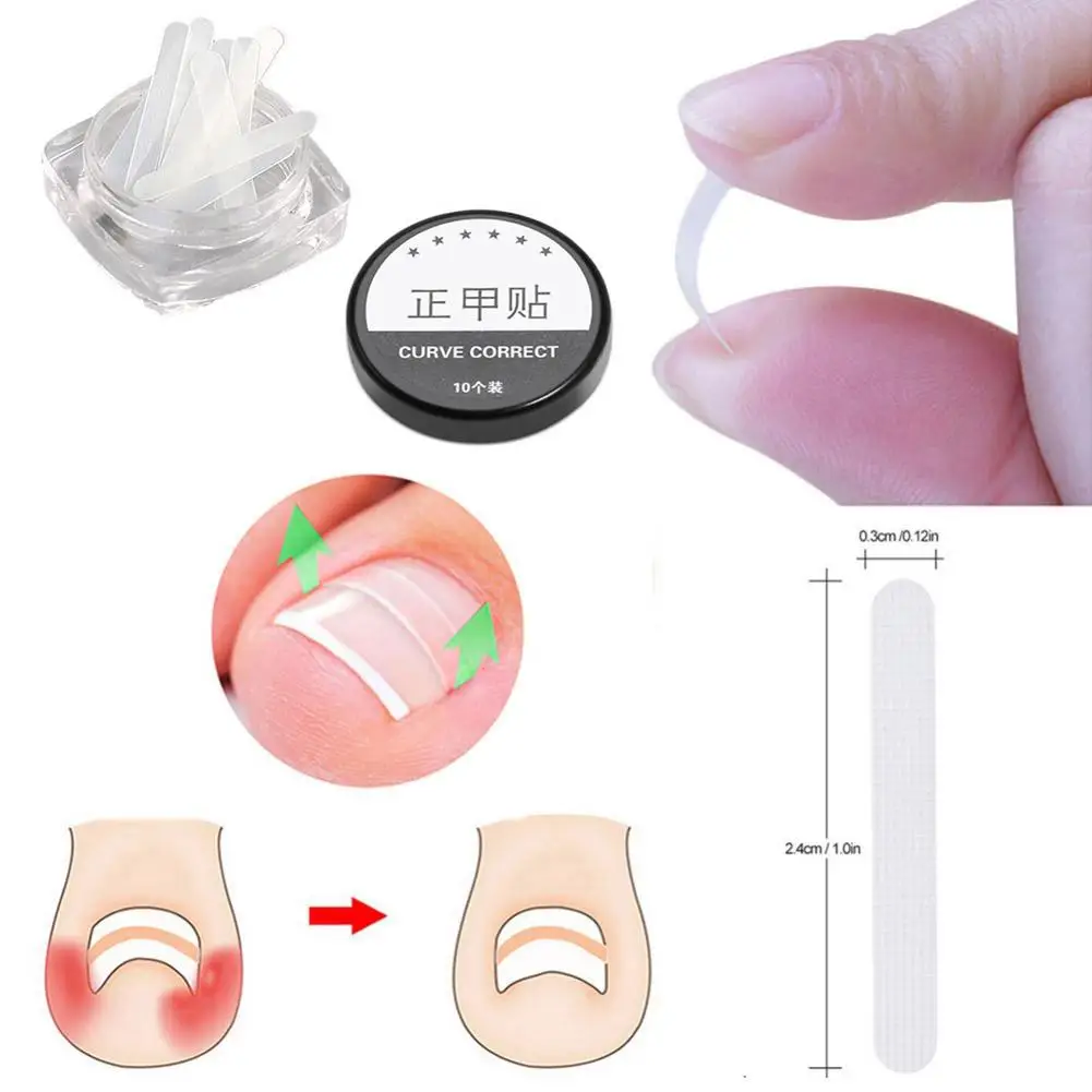 8 шт./компл. набор для ремонта ногтей слиток Дизайн ногтей Носок Набор Стикеры для ногтей фиксирующий корректирующий прибор с очиститель клея педикюр инструмент для ногтей