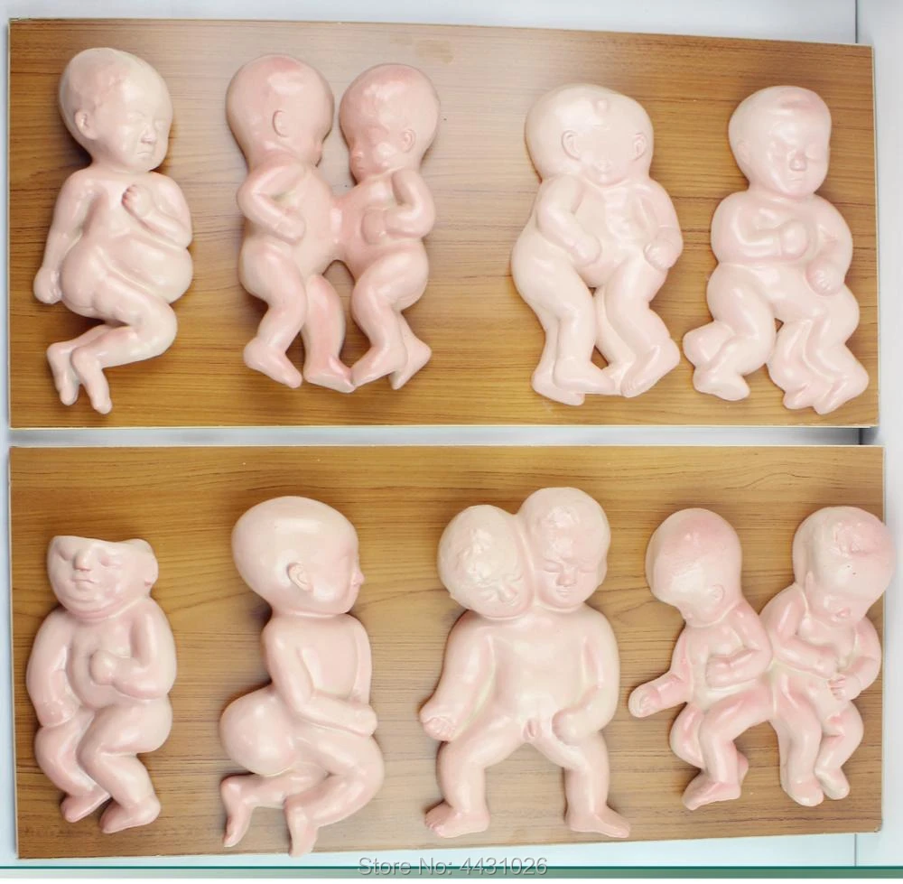 Medical Fetal Models