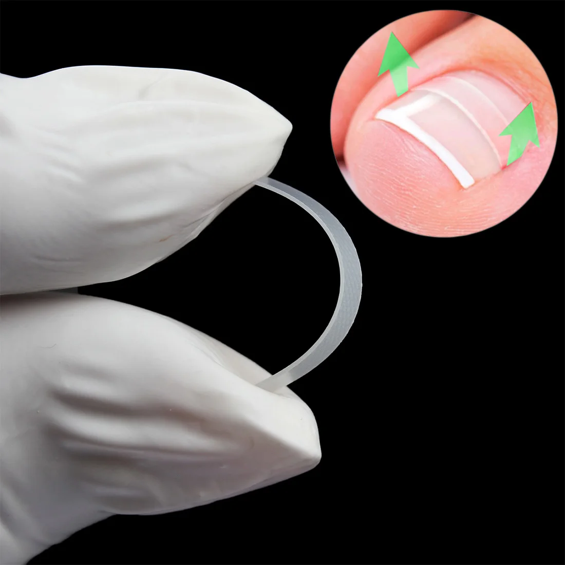 Paronychia Correction File Elastic Patch Corrector Treatment Tools 10pcs/box Toe Nail Ingrown Correction Sticker Patch Foot Care