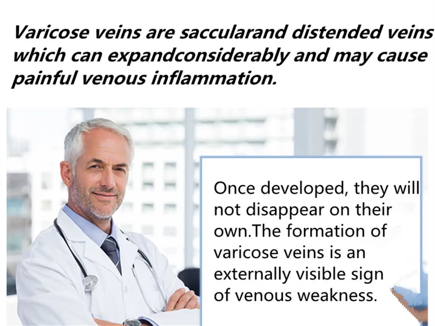 Compression stockings 7