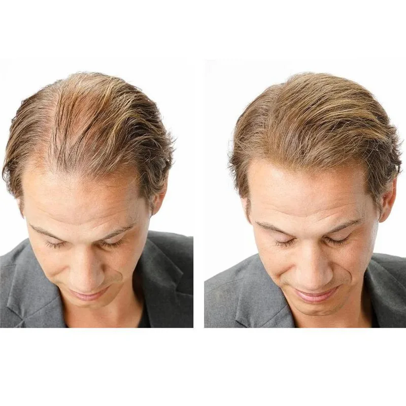 inspire-uplift-anti-hair-loss-fibers-anti-hair-loss-fibers-3529653977204_1000x