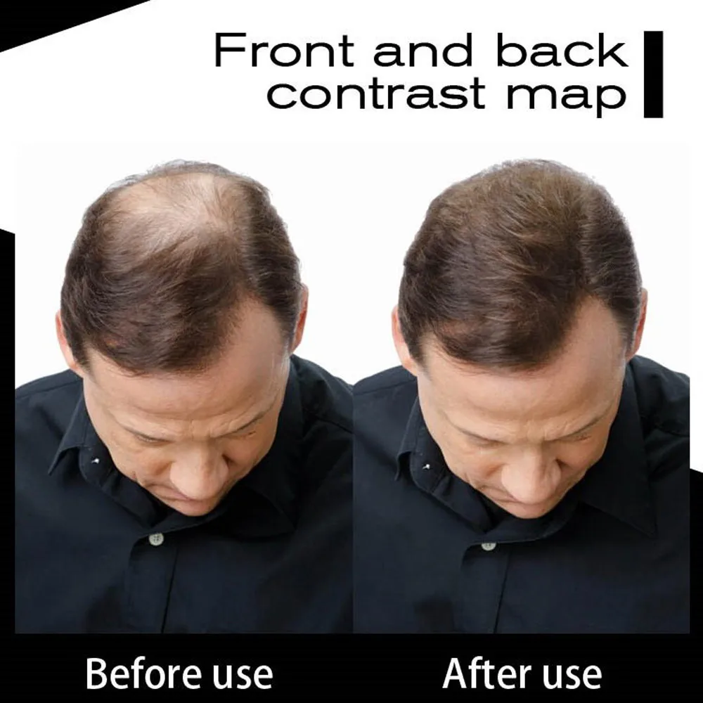 Прямая поставка Sevich Hair Fbers 25 г покрытие утонченные пакетировочные пятна