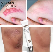 Лечение акне Кайман удаление черных точек крем против акне контроль масла сужение пор удаляет рубцы после акне уход за лицом; отбеливание