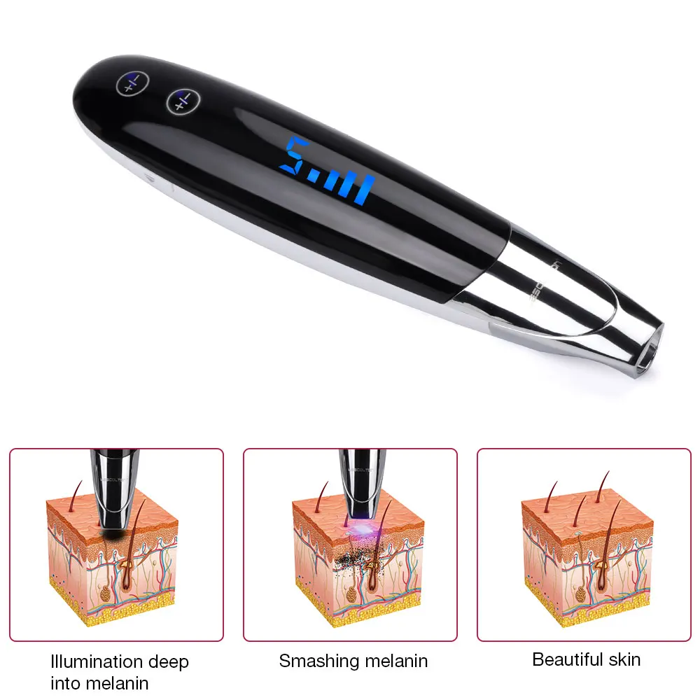 picosecond laser pen tattoo removal LMH181214-01 (8)