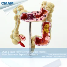 CMAM-INTESTINE01 Medical Science Anatomical Intestines Model