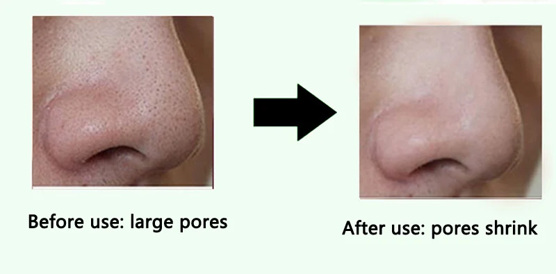 22-9394918317_91726198